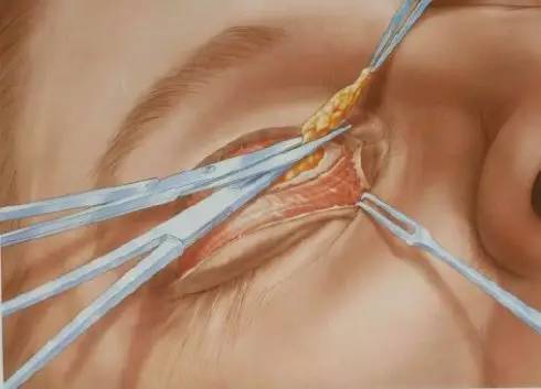 �D�����_�p��Ƥ���g(sh��)ȫ�^��