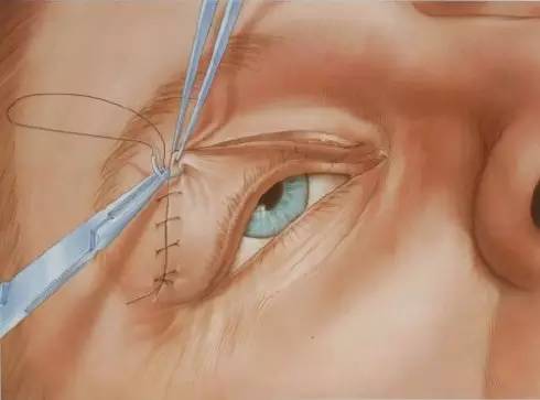 �D�����_�p��Ƥ���g(sh��)ȫ�^��