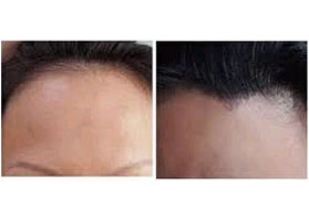 �Nֲ���˼�Ч����ô��