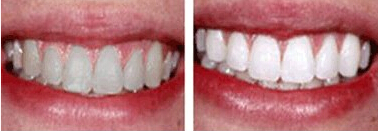 ���X����Ч���D