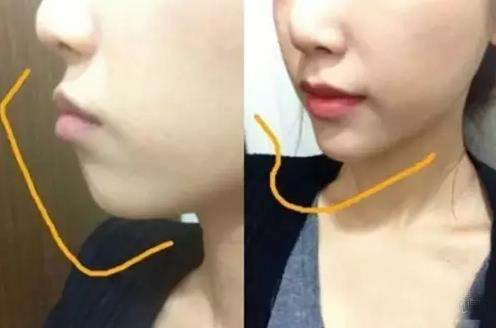 �°͌�Ę�͵����ж���Ҫ�����ķN�S�°͵ķ�������