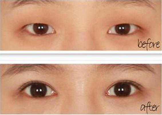 �_���۽����g(sh��)Ч����ô��