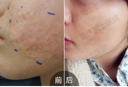 �ί������̺۳ɹ�����