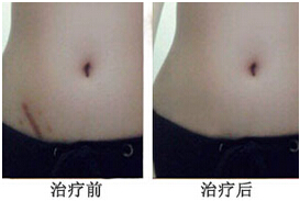 �ؑcȥ������̺۳ɹ�����