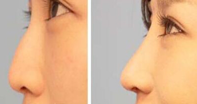 ����������¡��Ч���D