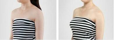 ������ͨ�ͼ��w¡��Ч���D