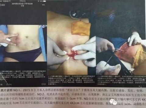 Ů����΢���u����֬ᘱ���һ���