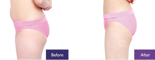 ������֬�����w򞰸��