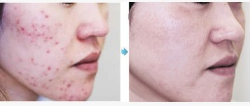 �t(y��)�W(xu��)������ɹ�����