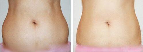 360��h(hu��n)��ˮ��(d��ng)����֬�ɹ�����