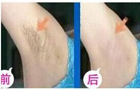 ������ë�ɹ�����