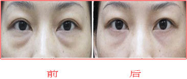 ���۴��ɹ�����