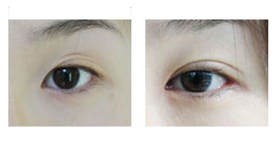 �̺ۿ�˫��Ƥ�޸��ɹ�����