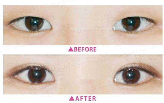 �ű��p��Ƥ�ɹ�����