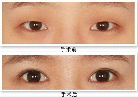 ��ʽ�űȵ��۳ɹ�����