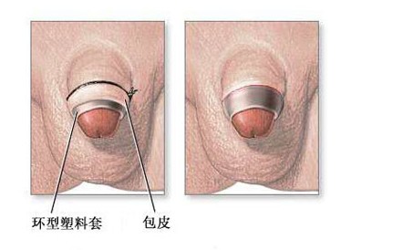 ��Ƥ�h(hu��n)���g(sh��)������Ҫ���L(zh��ng)�r(sh��)�g