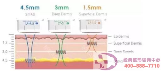 ����PK�ᬔ�������؃��ߵĲ�֮ͬ̎