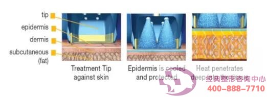 ����PK�ᬔ�������؃��ߵĲ�֮ͬ̎