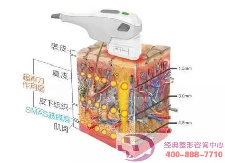 ����PK�ᬔ�������؃��ߵĲ�֮ͬ̎