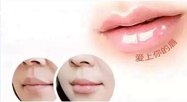 沈陽和平藍(lán)天人中再造適合哪些人群