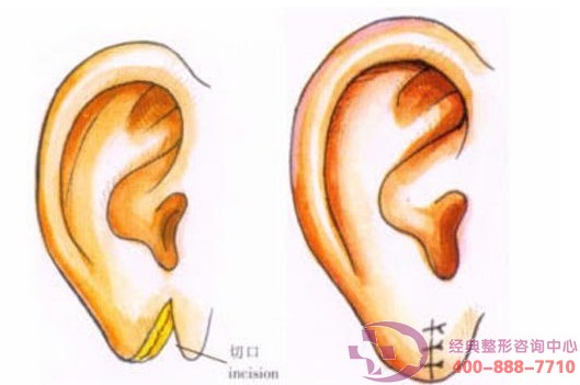 �\��Ѧ������������Ч����Ȼ��