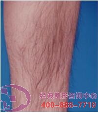 ����Óë�ɹ�����������ë���B������