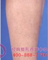 ����Óë�ɹ�����������ë���B������