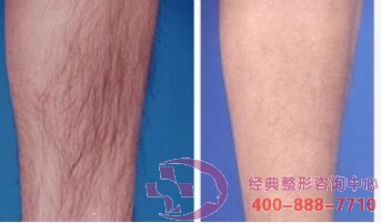 ����Óë�ɹ�����������ë���B������