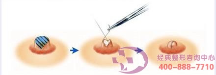 ���^�����g(sh��)��׌�鷿׃����