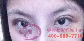 �N����ͫ�g(sh��)��׌�ғ��������p��