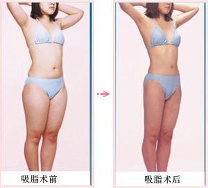 ��֬���������G������