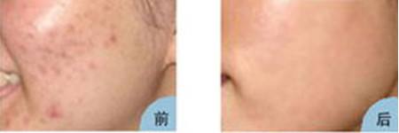 ���w��Ҫ�����ٴ�΢��ĥ���g(sh��)��