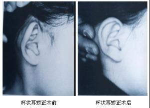 ��������ε��m��(y��ng)��Ⱥ