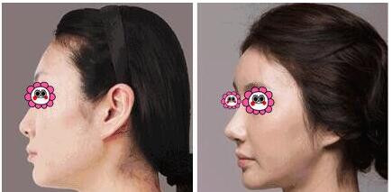 ����Ժ���x������������D�a(ch��n)�t(y��)Ժ�߳���(l��i)�������S����������