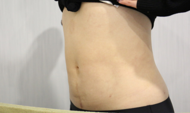 360�ȶ�S��֬��ˮͰ��׃���w��(x��)С��