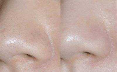 �տsë�׵�4�N����������⻬���w