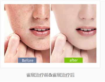 ����ȥȸ����ʲô���ɰY