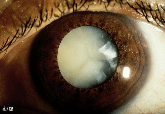 �׃�(n��i)���g(sh��)��ע���������Щ