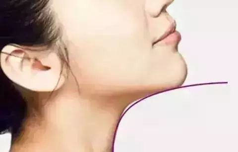 哪些隆下巴的方法不靠譜