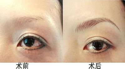 ü�������g(sh��)��ע�����(xi��ng)