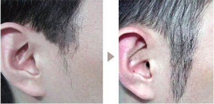 �W�ǷNֲ����ͼ��m����Ⱥ