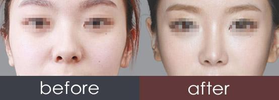 ���ڱ����x���F�(y��ng)�����t(y��)�����յ�¡��