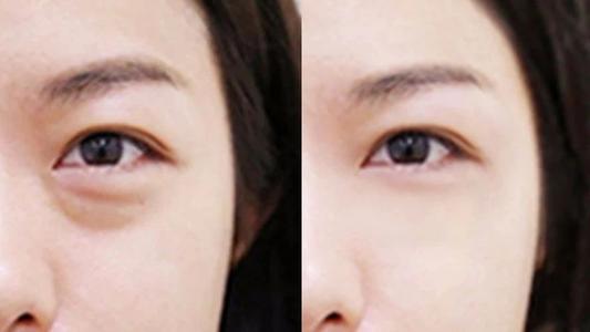 ��(n��i)�����۴����g(sh��)��ô��