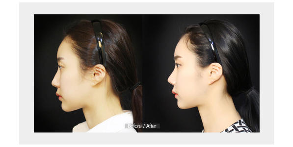 ���w¡�����g