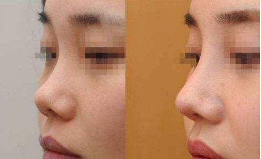 ����������g(sh��)�ă�(y��u)����ʲô