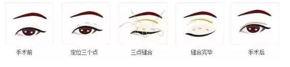 2019���p��Ƥ������������һ�N���m���Լ�