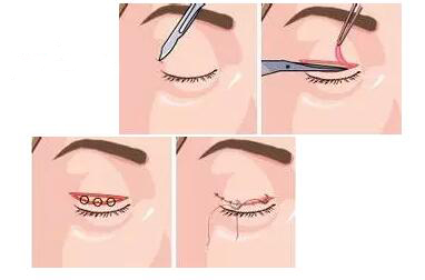 2019���p��Ƥ������������һ�N���m���Լ�