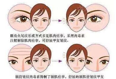 �۽�ȥ���y���������N