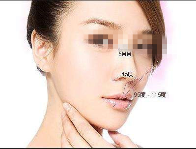 ¡���ޏ�(f��)���g(sh��)ע�������ʲô��