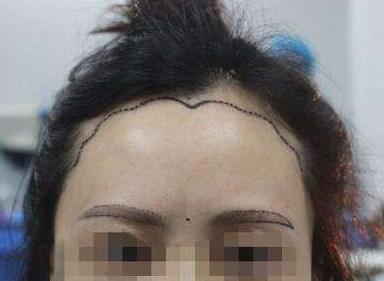 ���˼�Nֲ���g(sh��)���ð���סԺ